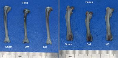 The Hyperglycemia and Hyperketonemia Impaired Bone Microstructures: A Pilot Study in Rats